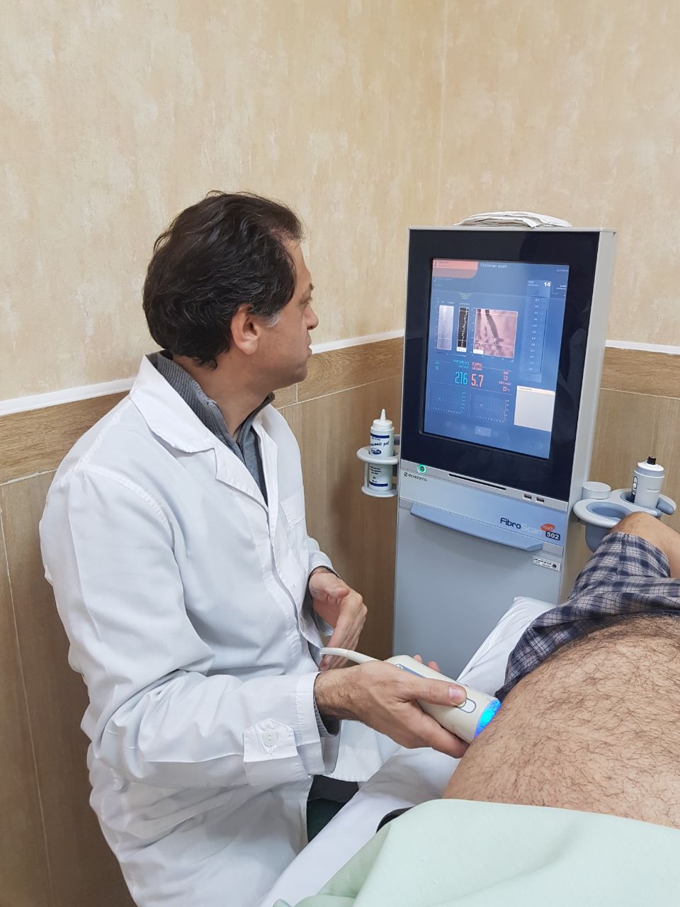 فیبرواسکن